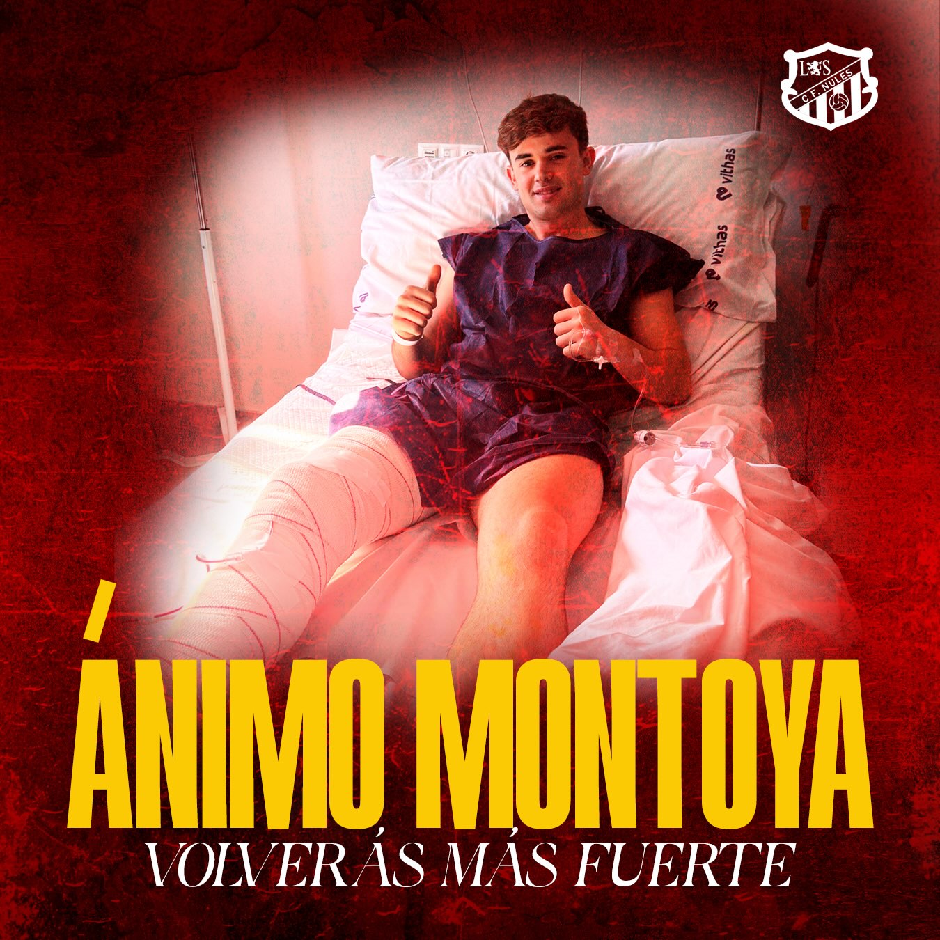 Hoy nuestro querido @raulmontoya_04 ha sido intervenido satisfactoriamente de la lesión que sufrió en pretemporada.
Comenzamos el camino de recuperación juntos y seguro que será más corto de lo esperado.💪🏼

ANIMO MONTOYA, YA QUEDA UN DÍA MENOS PARA VOLVER!!
💪🏼❤️🦁

#cfnules #rogets #somequipsomnules #tornemasomiar